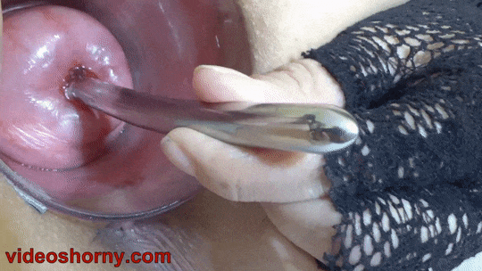 Period Pussy Being Fucked - Saline Uterus Inflation. Cervix Penetration with Menstruation Porn